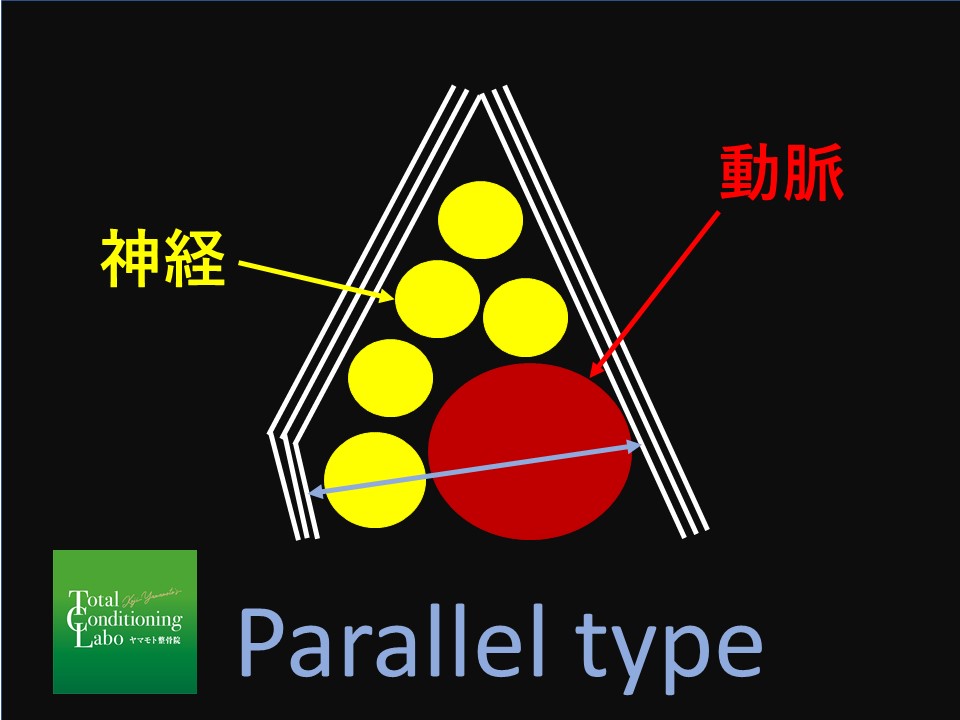 TOS　胸郭出口症候群